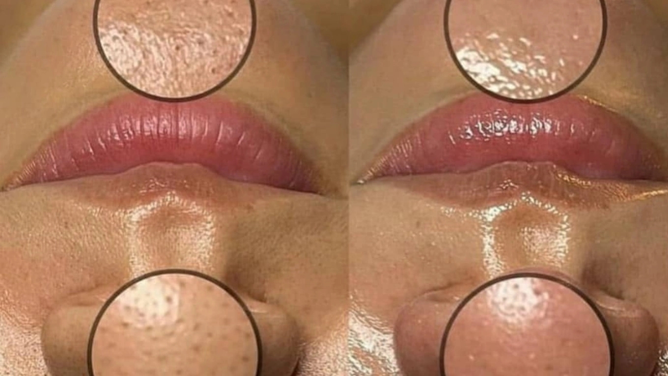 ماسک صورت کربن فعال ویتابلا