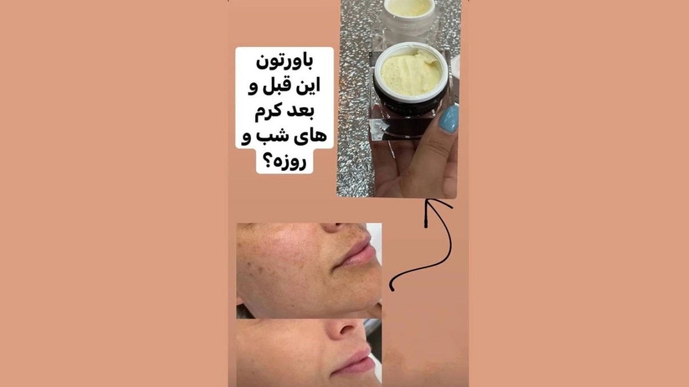کرم شب لاکچری کوین