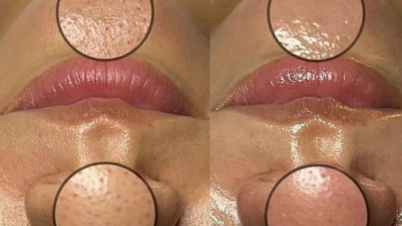 ماسک صورت کربن فعال ویتابلا
